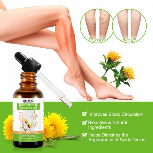 SEFUDUN Varicose Veins Essential Oil 30ml Improving Blood Circulation