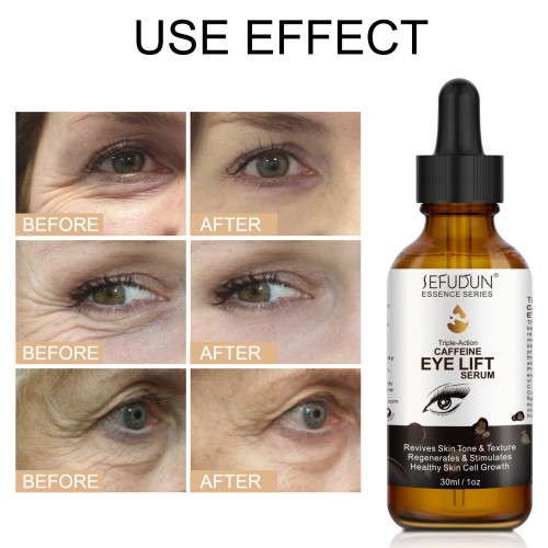 SEFUDUN Triple-Action Caffeine Eye Lift Serum 30ml Removing Dark Circles Anti-wrinkle